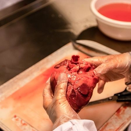 Hjerte-lungedissektion