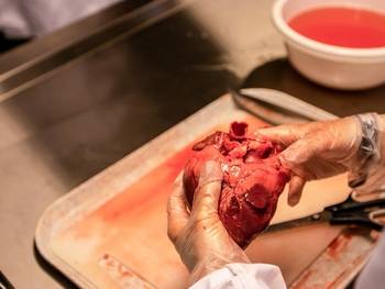 Hjerte-lungedissektion